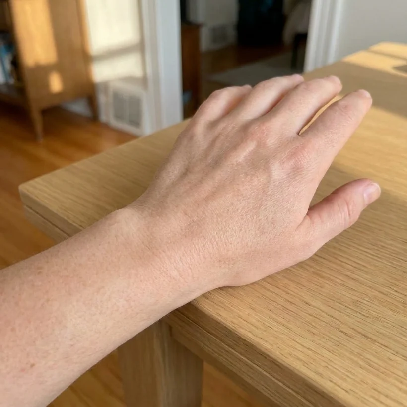 Week-12 result — calm, settled, even-toned skin, flare-free