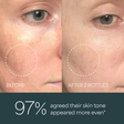 Skin Science Clinical Peptide Serum before and after comparison of skin tone with text indicating improvement.