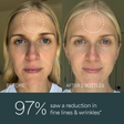 Skin Science Clinical Peptide Serum before and after comparison in the reduction of fine lines and wrinkles.