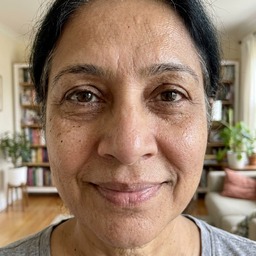 Maria's under-eyes — week 2