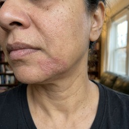 Maria's neck — week 2