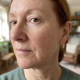 Sharon's cheek — after, calm