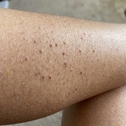 Maria's calf — week 2