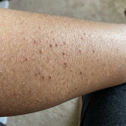 Maria's calf — week 6