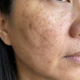 Maria's cheek — week 2