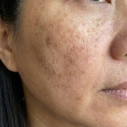 Maria's cheek — week 6