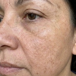 Sharon's cheek — after, even tone